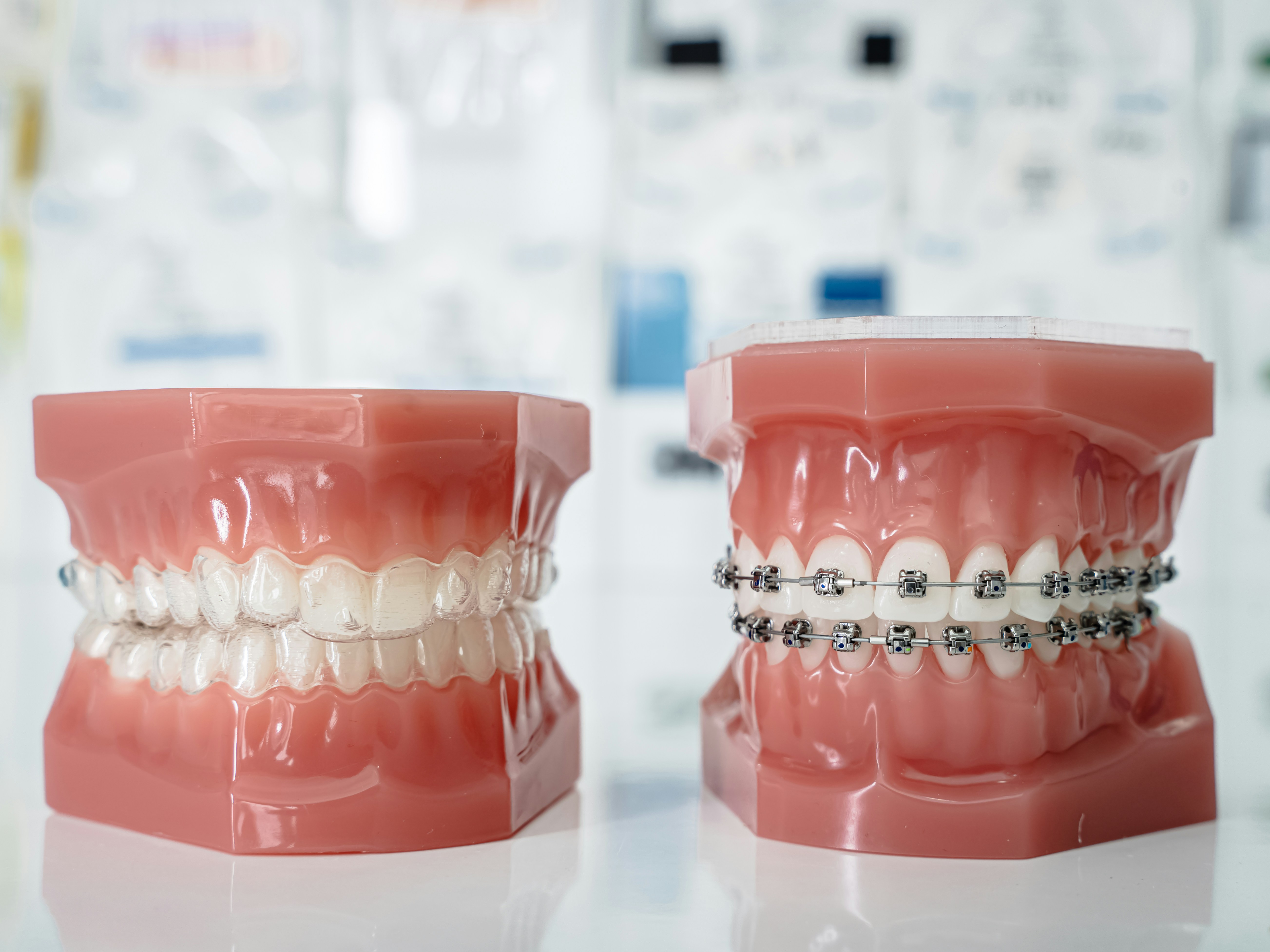 Braces options for adults